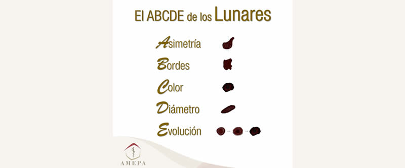 El ABCDE de los lunares